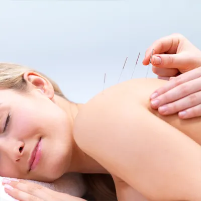 Chiropractic San Diego CA Acupuncture Service